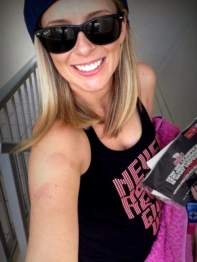 Battle wounds … two hours later.  